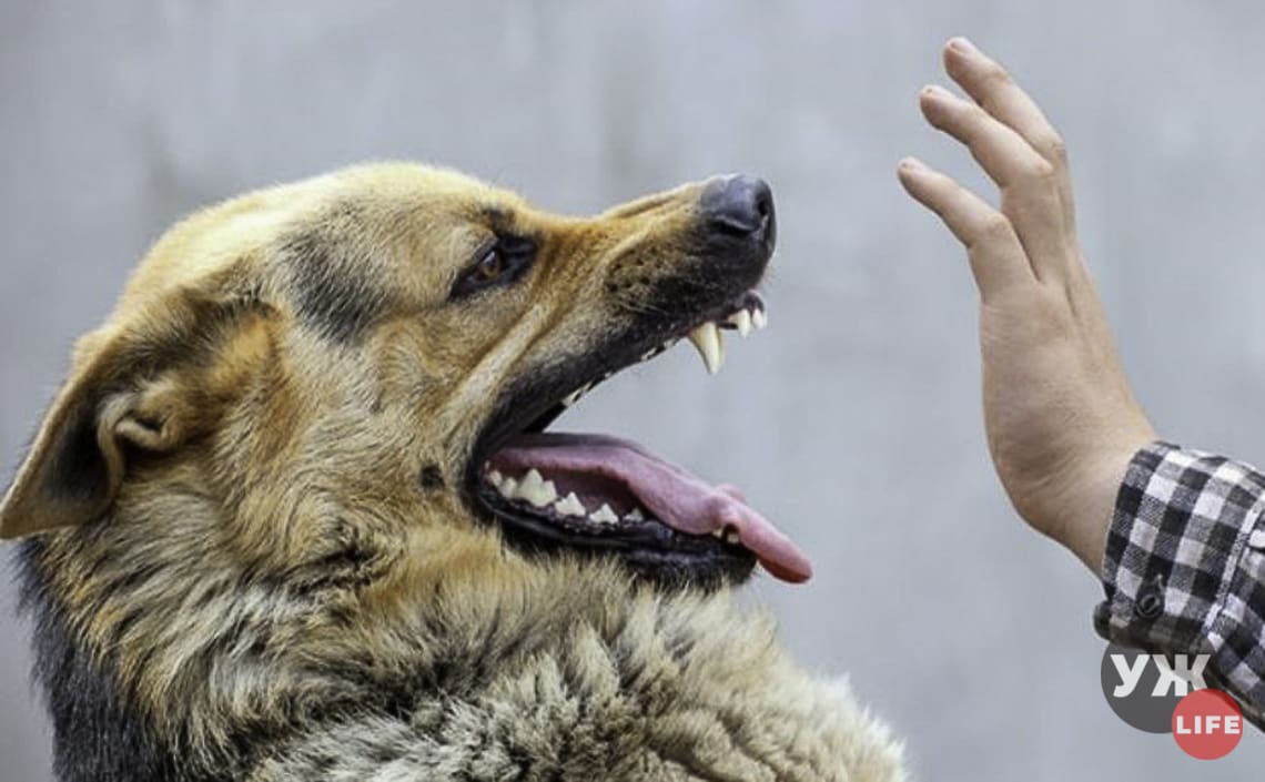 На Житомирщині хворий на сказ пес покусав чотирьох людей, господар застрелив тварину